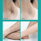 🔥Hot Sale🔥 Painless Full Body Hair Removal Cream for Men & Women